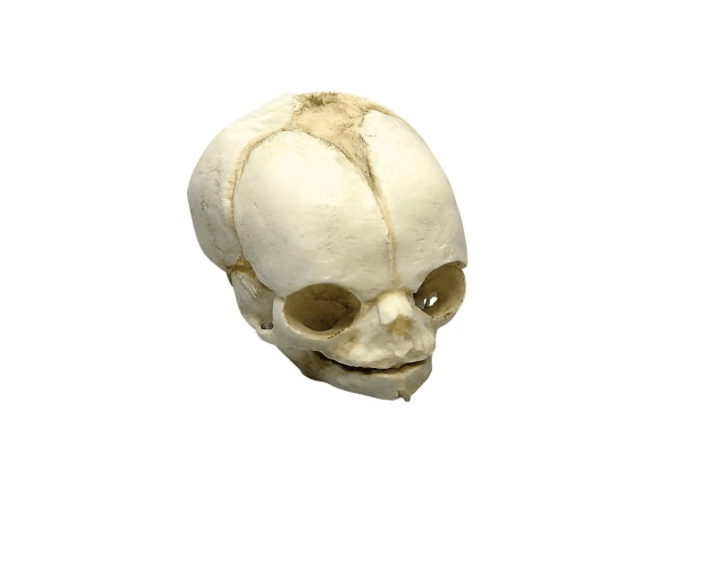 Fetusschädel, 21 ½ Wochen – präzises Modell zur Darstellung der frühen Schädelentwicklung - Erler - Zimmer